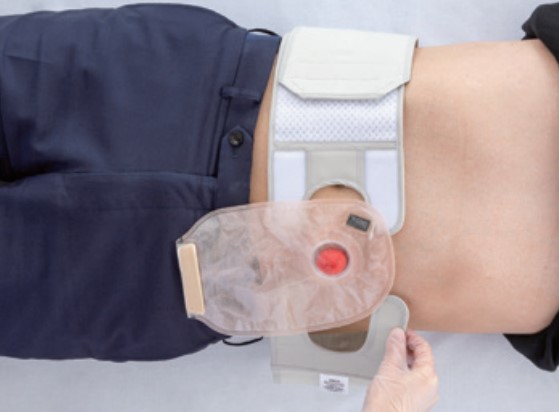 パラストーマベルト（アルケア）｜ザイタックオンラインストア