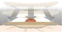 【20%オフ】423647 エスティーム ボディ 凸3.5mm 30mm エスティームボディ（高さ3.5mm）（コンバテック）｜ザイタック