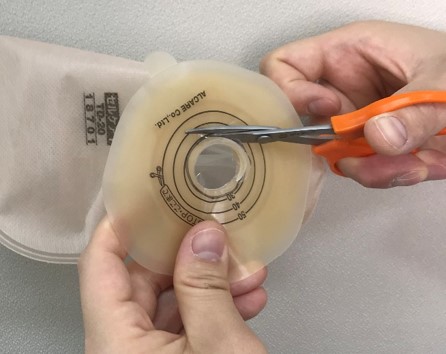 ストーマ装具の交換手順｜ザイタック通信｜ストーマ装具販売。給付券の